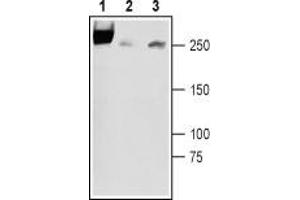 Western blot analysis of rat newborn brain lysates (lanes 1 and 3), rat adult brain membranes (lane 2): - 1,2. (SCN3A Antikörper  (3rd Extracellular Loop, Domain 1))