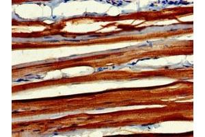 Immunohistochemistry of paraffin-embedded human skeletal muscle tissue using ABIN7160604 at dilution of 1:100 (MYBPC2 Antikörper  (AA 739-1141))