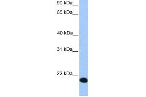 WB Suggested Anti-ZNF833P Antibody Titration:  0. (LOC401898 Antikörper  (Middle Region))