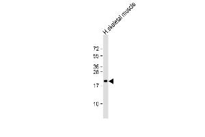 Anti-NACA2 Antibody (N-Term) at 1:2000 dilution + human skeletal muscle lysate Lysates/proteins at 20 μg per lane. (NACA2 Antikörper  (AA 36-69))
