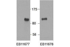 Western Blotting (WB) image for anti-Hypermethylated in Cancer 1 (HIC1) (AA 193-204) antibody (ABIN5868799) (HIC1 Antikörper  (AA 193-204))
