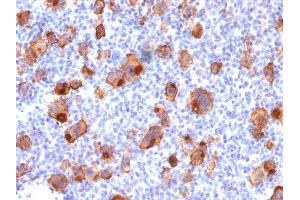Immunohistochemistry (IHC) image for anti-Tumor Necrosis Factor Receptor Superfamily, Member 8 (TNFRSF8) antibody (ABIN6941149)