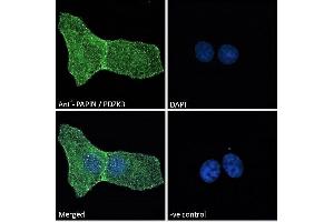 ABIN185158 Immunofluorescence analysis of paraformaldehyde fixed U2OS cells, permeabilized with 0. (PDZD2 Antikörper  (N-Term))