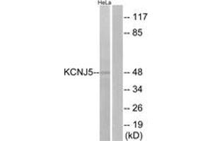 Western blot analysis of extracts from HeLa cells, using KCNJ5 Antibody. (KCNJ5 Antikörper  (AA 370-419))