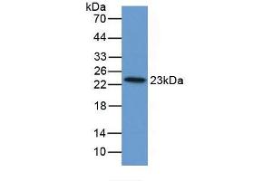 Figure. (FTL Antikörper  (AA 1-175))