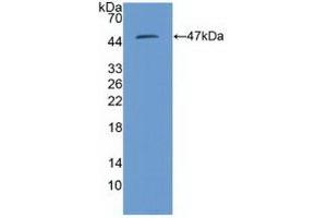 Detection of Recombinant PSMD13, Human using Polyclonal Antibody to Proteasome 26S Subunit, Non ATPase 13 (PSMD13) (PSMD13 Antikörper  (AA 1-378))