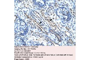 Human kidney (ANKRD11 Antikörper  (N-Term))
