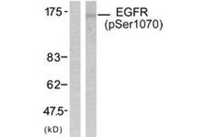 Western blot analysis of extracts from SK-OV3 cells treated with EGF, using EGFR (Phospho-Ser1070) Antibody. (EGFR Antikörper  (pSer1070))