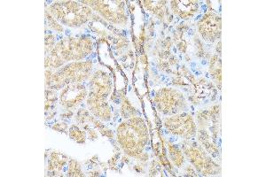 Immunohistochemistry of paraffin-embedded mouse kidney using Sec23AA Rabbit mAb (ABIN7270168) at dilution of 1:100 (40x lens). (SEC23A Antikörper)