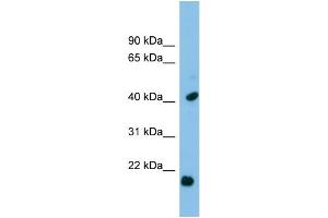 WB Suggested Anti-HSPB2 Antibody Titration: 0.