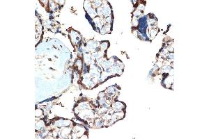 Immunohistochemistry of paraffin-embedded human placenta using  Rabbit mAb (ABIN7265406) at dilution of 1:100 (40x lens). (ATF5 Antikörper)