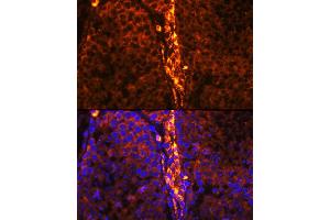 Immunofluorescence analysis of mouse testis using RBP1 Rabbit pAb (ABIN6129597, ABIN6146795, ABIN6146796 and ABIN6214136) at dilution of 1:100 (40x lens). (RBP1 Antikörper  (AA 63-197))