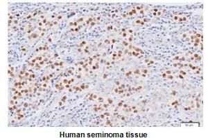 Paraffin embedded sections of human seminoma tissue were initrocelluloseubated with anti-human Nanog (1:50) for 2 hours at room temperature. (Nanog Antikörper  (AA 1-154))