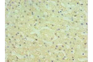 Immunohistochemistry of paraffin-embedded human liver tissue using ABIN7155969 at dilution of 1:100 (HYAL1 Antikörper  (AA 136-435))