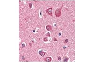 Immunohistochemistry (IHC) image for anti-PTEN Induced Putative Kinase 1 (PINK1) antibody (ABIN356391) (PINK1 Antikörper)