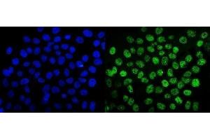 IF analysis of SUMO2/3 using anti-SUMO2/3 antibody (ABIN7600856). (SUMO2/3 Antikörper  (AA 24-72))