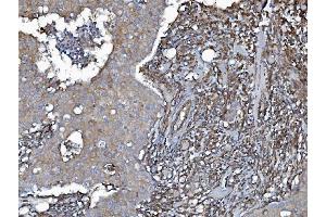 IHC analysis of EHD3 using anti-EHD3 antibody (ABIN7602777). (EHD3 Antikörper  (C-Term))