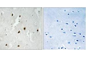 Immunohistochemistry analysis of paraffin-embedded human brain, using FOXO4 (Phospho-Ser262) Antibody. (FOXO4 Antikörper  (pSer262))
