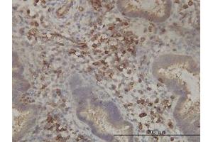 Image no. 1 for anti-Pantothenate Kinase 2 (PANK2) (AA 205-260) antibody (ABIN599308) (PANK2 Antikörper  (AA 205-260))