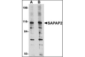 Western blot analysis of SAPAP2 in L1210 cell lysate with this product at (A) 0.