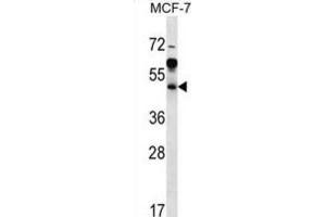 Western Blotting (WB) image for anti-ADP-Ribosylation Factor Interacting Protein 1 (ARFIP1) antibody (ABIN2997067) (ARFIP1 Antikörper)