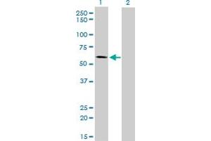 Western Blotting (WB) image for anti-Alkaline Phosphatase, Placental-Like 2 (ALPPL2) (AA 365-455) antibody (ABIN769091) (ALPPL2 Antikörper  (AA 365-455))