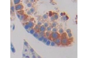 IHC-P analysis of Human Tissue, with DAB staining. (HSPA1L Antikörper  (AA 1-641))