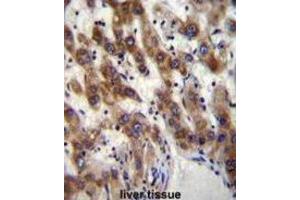 Immunohistochemistry (IHC) image for anti-PHD Finger Protein 20 (PHF20) antibody (ABIN2996558) (PHF20 Antikörper)