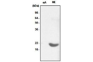Recombinant crystallin alpha A (alphaA) and the extract of mouse eye (ME) were resolved by SDS-PAGE, transferred to PVDF membrane and probed with anti-human crystallin alpha B antibody (1:1,000). (CRYAB Antikörper)