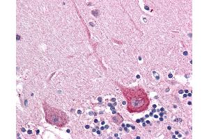 Anti-DLGAP2 antibody IHC of human brain, cerebellum. (DLGAP2 Antikörper  (Internal Region))