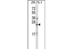 RLN1/RLN2 Antibody (C-term) (ABIN657785 and ABIN2846759) western blot analysis in ZR-75-1 cell line lysates (35 μg/lane). (RLN1,RLN2 Antikörper  (C-Term))