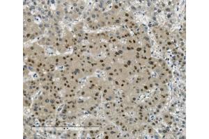 IHC analysis of Transketolase/TKT using anti-Transketolase/TKT antibody (ABIN7598957).
