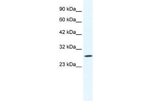 WB Suggested Anti-CLIC1 Antibody Titration:  1. (CLIC1 Antikörper  (N-Term))