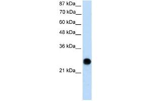 VDAC2 antibody used at 0. (VDAC2 Antikörper  (N-Term))