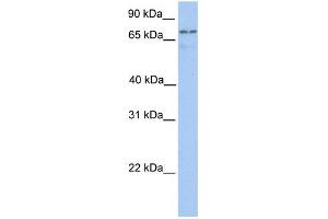WB Suggested Anti-TGM7 Antibody Titration:  0. (Transglutaminase 7 Antikörper  (C-Term))