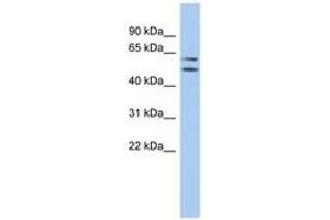 Image no. 1 for anti-Abhydrolase Domain Containing 15 (ABHD15) (AA 107-156) antibody (ABIN6743745) (ABHD15 Antikörper  (AA 107-156))