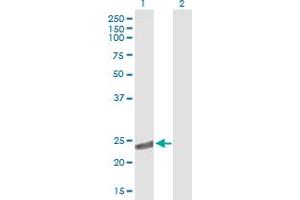Western Blot analysis of CRYBA2 expression in transfected 293T cell line by CRYBA2 MaxPab polyclonal antibody. (CRYbA2 Antikörper  (AA 1-197))