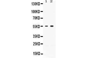 Western blot analysis of ACVR2B expression in rat skeletal muscle extract ( Lane 1) and MCF-7 whole cell lysates ( Lane 2). (ACVR2B Antikörper  (C-Term))