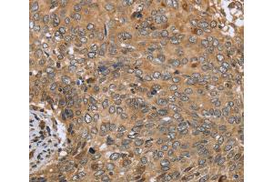 Immunohistochemistry (IHC) image for anti-C-Type Lectin Domain Family 16, Member A (CLEC16A) antibody (ABIN2433461)