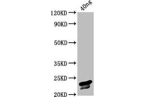 anti-Chicken Anemia Virus VP3 (CAV VP3) (AA 1-120) antibody