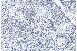 Immunohistochemical analysis of paraffin-embedded human spleen section using GREMLIN Antibody (C-term) (ABIN390078 and ABIN2840598). (GREM1 Antikörper  (C-Term))