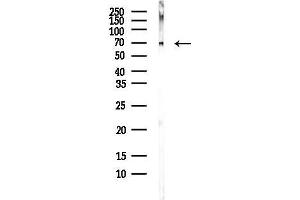 Western blot analysis of lysates from COLO205 cells(heat-shock,45 min treatment), using RP Antibody at 1/1000 dilution.