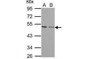 WB Image Sample (30 ug of whole cell lysate) A: PC-3 B: U87-MG 10% SDS PAGE antibody diluted at 1:1000 (CXCR7 Antikörper)
