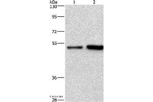 Western blot analysis of Hela and Jurkat cell, using SYT4 Polyclonal Antibody at dilution of 1:700 (SYT4 Antikörper)