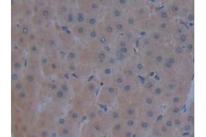 Detection of C3 in Human Liver Tissue using Polyclonal Antibody to Complement Component 3 (C3) (C3 Antikörper  (AA 1000-1326))