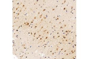 anti-Fibroblast Growth Factor 2 (Basic) (FGF2) (N-Term) antibody