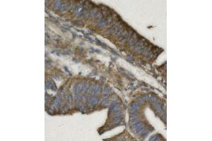 IHC analysis of REA/PHB2 using anti REA/PHB2 antibody (ABIN7599240). (Prohibitin 2 Antikörper  (AA 1-299))