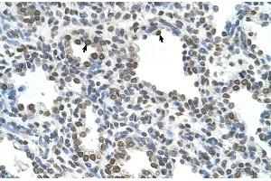 Rabbit Anti-NKD1 Antibody  Paraffin Embedded Tissue: Human Lung Cellular Data: Alveolar cells Antibody Concentration: 4.