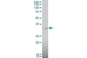 MAP2K6 monoclonal antibody (M02), clone 2F2 Western Blot analysis of MAP2K6 expression in COLO 320 HSR . (MAP2K6 Antikörper  (AA 231-334))