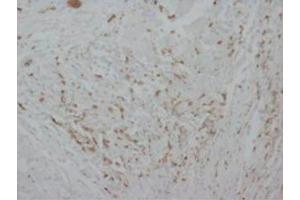 Immunohistochemical analysis of paraffin embedded Human tissue sections (ovary) using Myeloperoxidase antibody (Myeloperoxidase Antikörper  (C-Term))